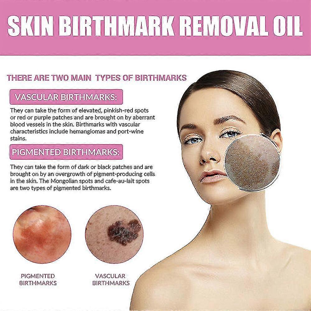 Two 10ml bottles of 13373 birthmark removal face oil and serum for skin blemish treatment, shown in the image.