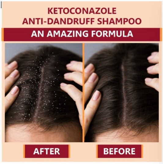 Bottle of 110ml Ketokem anti-dandruff shampoo by 6255 with clear label, shown in a close-up image.