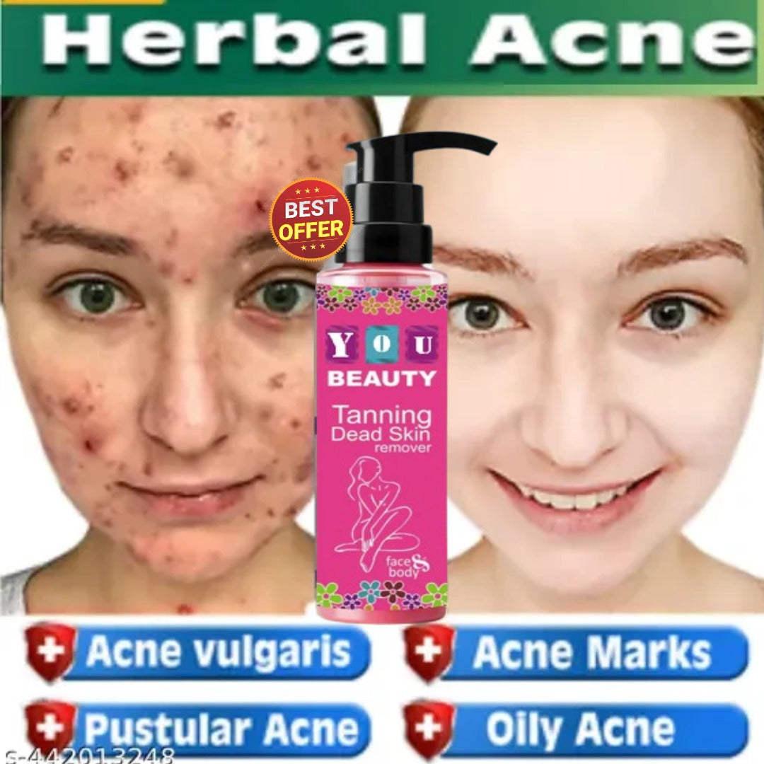 18307 black head remover cream for tanning and dead skin removal, showing pink packaging and textured cream inside.