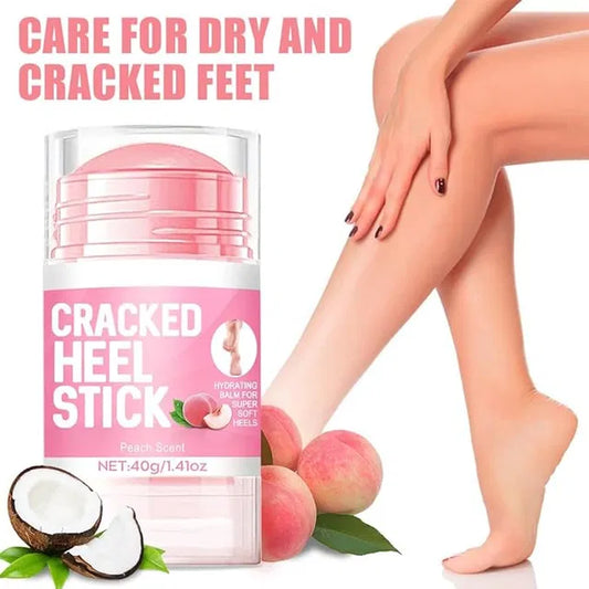 Urea Foot and Hand Cream Stick with 2% Salicylic Acid for skin repair and restoration, 1.41 oz, from 19384.