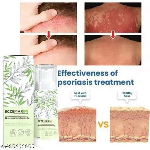 Eczemaron anti-fungal face cream for ringworm, eczema, and fungal infections, moisturizing skin with 16182 brand product.