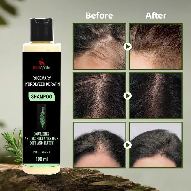 Rosemary Hydrolyzed Keratin Shampoo 100 ml from 27555, shown in a pack of two bottles, for nourishing hair and scalp care.