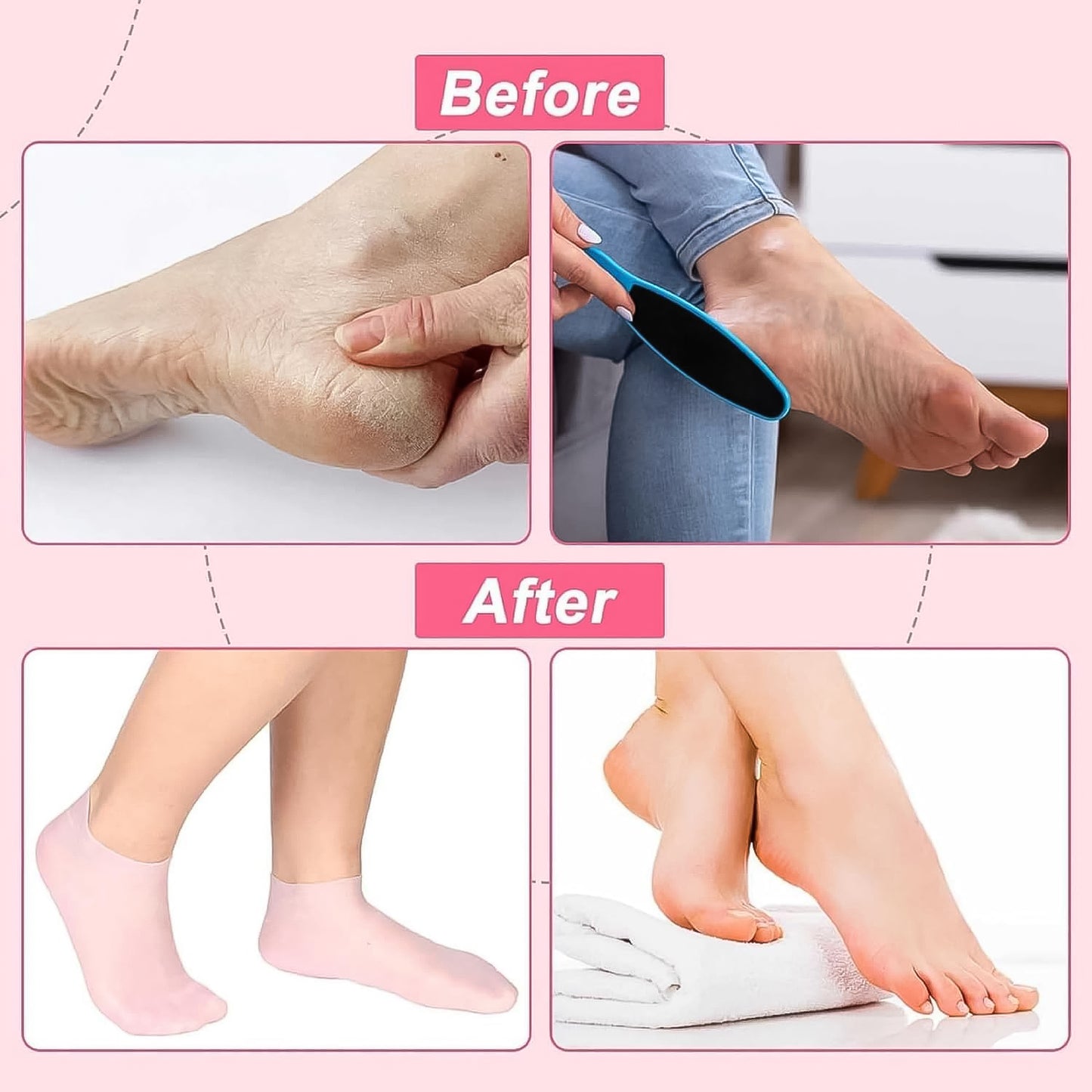 Pair of Wukusy silicone moisturizing socks for dry feet, soft and flexible, designed for skincare and hydration.