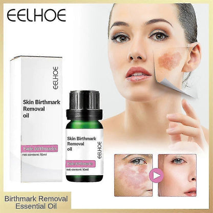 Two bottles of 13373 Birthmark Removal Oil 10ML, face serum for skin mark fading, multicolor packaging, pack of two