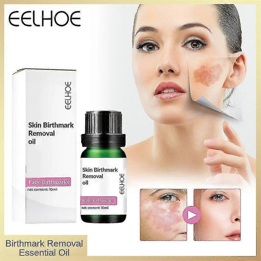 Two bottles of 13373 Birthmark Removal Oil 10ML, face serum for skin mark fading, multicolor packaging, pack of two