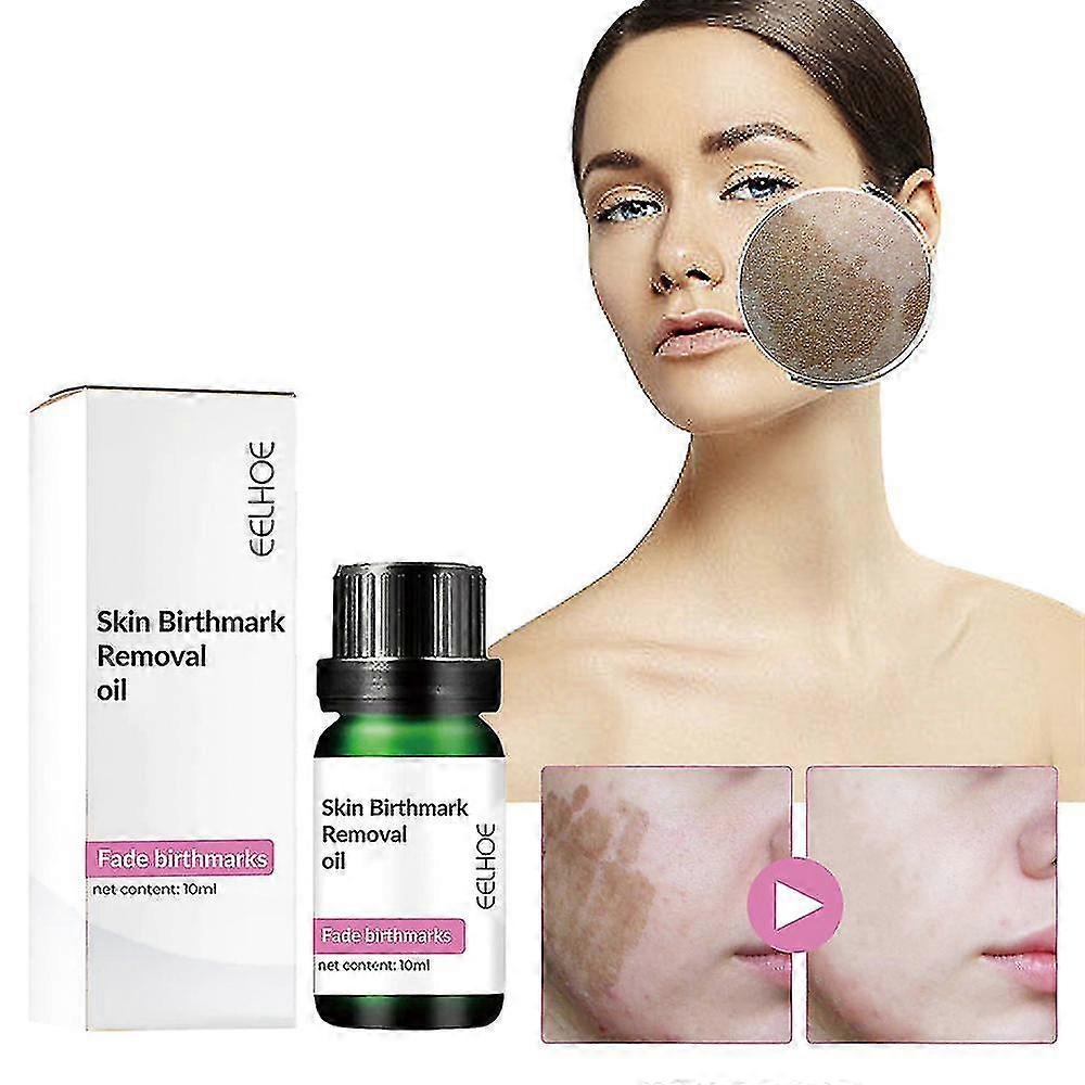 Two 10ml bottles of 13373 birthmark removal face oil and serum with multicolor packaging, designed for skin blemish treatment.