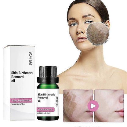 Two 10ml bottles of 13373 birthmark removal face oil and serum with multicolor packaging, designed for skin blemish treatment.