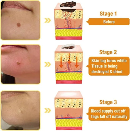 Ozelle Gold Foil Peel-Off Mask by Beilingmei, a gold face mask for wrinkles, shown in 50g pack with foil peel-off design.