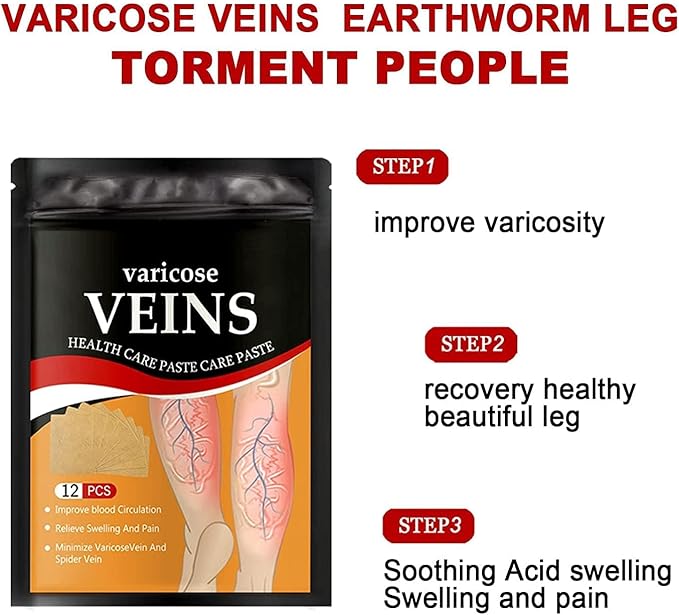 Heat patches for varicose veins and spider veins on legs, 12-piece set for leg vein relief and removal.