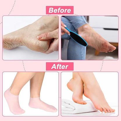 Multicoloured natural oil spa gel socks, moisturizing socks pack of 2, featuring gel-lined design for soothing foot care.