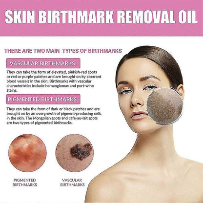Two 10ml bottles of 13373 birthmark removal face oil and serum for skin blemish treatment, shown in the image.