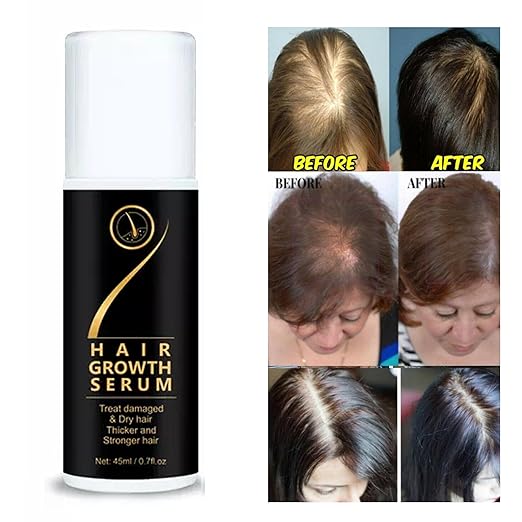 18277 hair growth serum spray for damaged, dry hair, promoting thicker, stronger hair with nourishing treatment