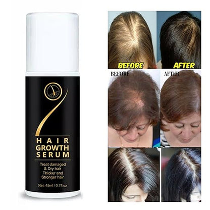 18277 hair growth serum spray for damaged, dry hair, promoting thicker, stronger hair with nourishing treatment