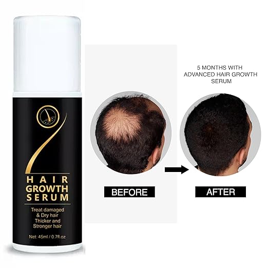 18277 Hair Growth Serum Hair Spray for damaged, dry, and thinning hair; promotes thicker, stronger, healthier hair.
