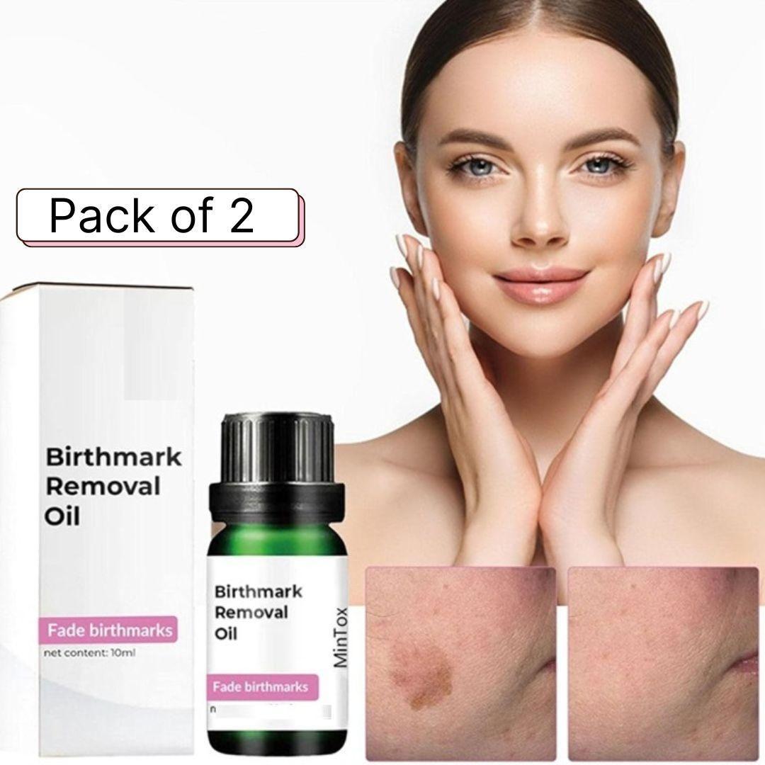 Two 10 ml bottles of 18051 birthmark removal massage oil, clear bottles with dropper caps, designed for skin treatment.