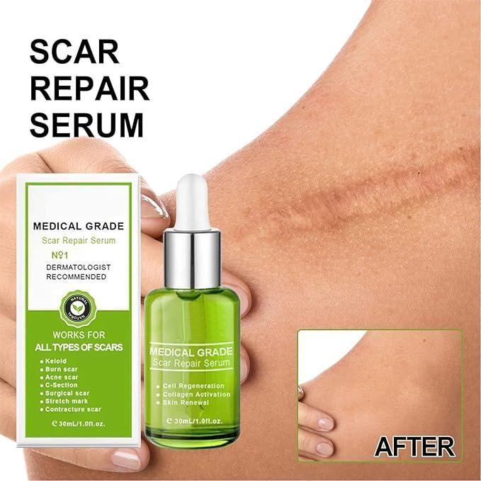 18051 Scar Repair Essence gel in a 30ml bottle, designed to reduce scars and stretch marks, with a smooth, clear texture.