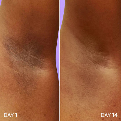 Two 40ml bottles of 18074 Under Arm Roll On stretch marks and scar cream, shown with applicator tips on the bottles.