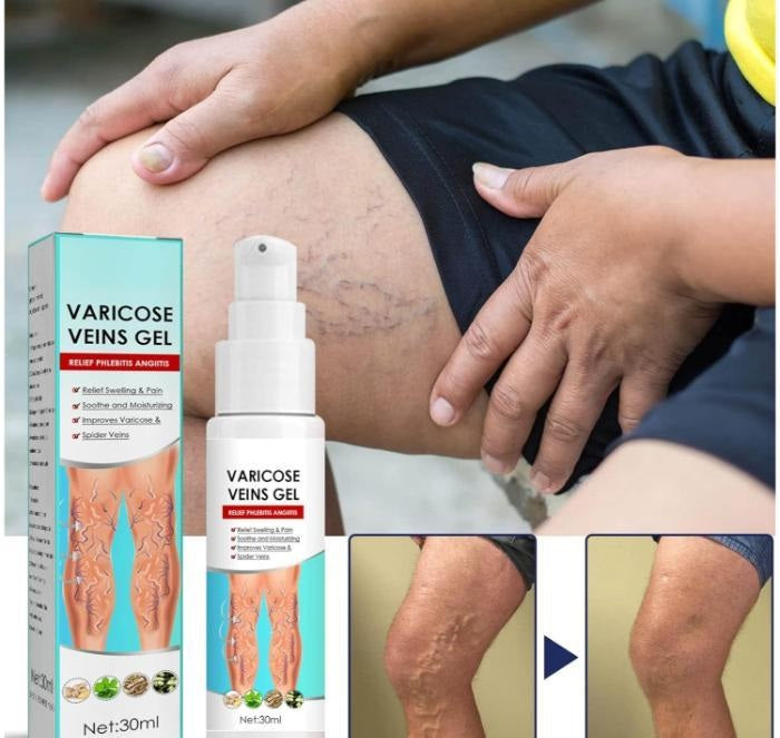 Varicose veins gel in a pack of two, part of the stretch marks, scars, and skin care creams by 5912, with applicator tubes visible.