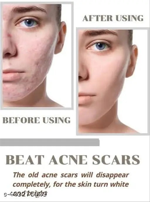 Niacid Face Serum by 9242 for skin brightening and anti-aging, shown in a sleek bottle with a pump applicator.