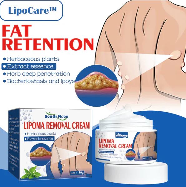 9242 Doctor's No 1 choice Lipoma Removal Cream for stretch marks and scars, shown in a tube with product branding.