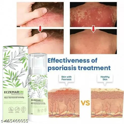 9242 Eczemaron antifungal cream for ringworm, eczema, and fungal infections, shown in a pack of two tubes.