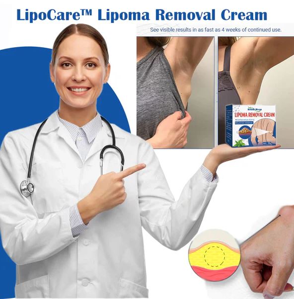 Box of Doctor's No 1 Choice Lipoma Removal Cream from 9242, designed for stretch marks, scars, and skin rejuvenation.