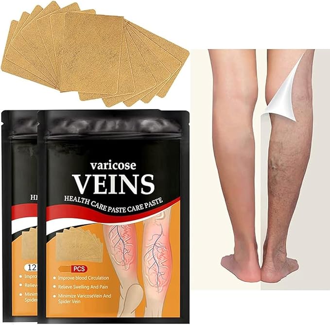 Heat patches for varicose veins treatment, 12 pcs varicose veins remover patches for legs and spider vein relief.