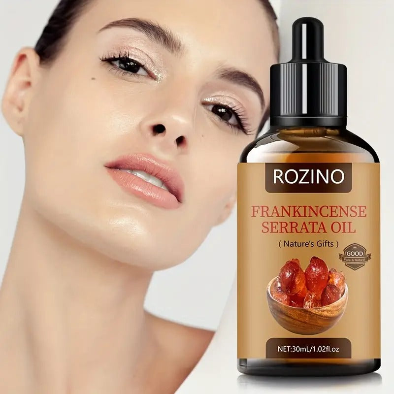 Rozino Frankincense Serrata Oil for stretch marks and scars by 5912, shown in a clear bottle with a natural background.