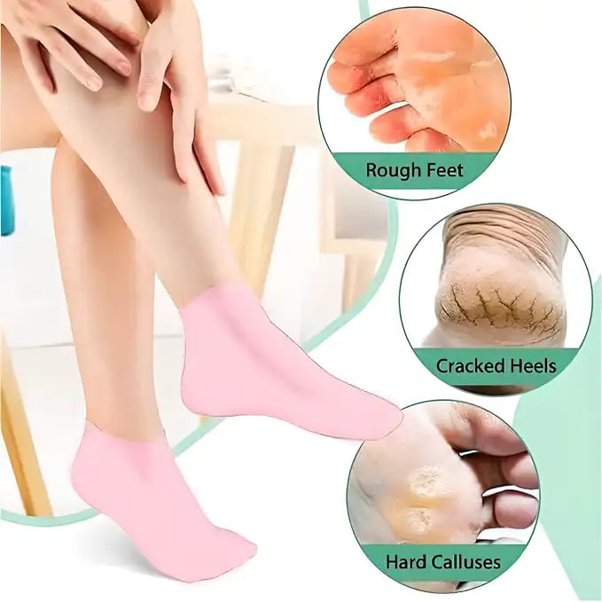 Silicone gel heel socks with anti-slip design for dry, cracked feet, providing moisture and comfort for foot care.