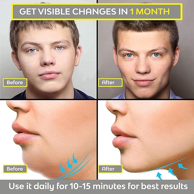 Jawline exerciser tool for men and women, face and neck toning straps to define jawline and reduce double chin.