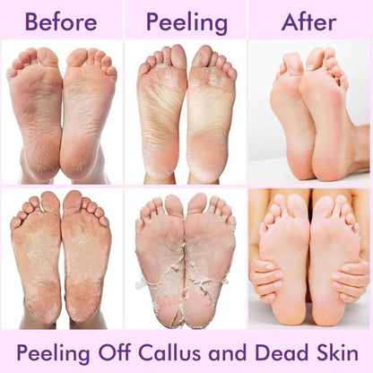 Exfoliating and hydrating foot mask sock from 19378, designed for pedicure foot scrubs with moisturizing and exfoliating properties.