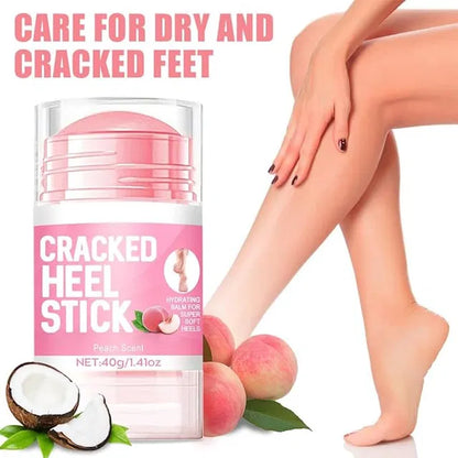 Urea Foot and Hand Cream Stick with 2% Salicylic Acid for skin repair and restoration, 1.41 oz, from 19384.