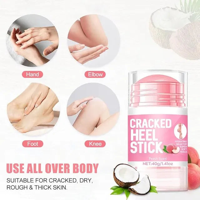 19384 Urea Cream with 2% Salicylic Acid in a 1.41 oz stick for foot and hand skin repair and restoration.