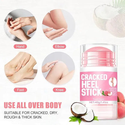 19384 Urea Cream with 2% Salicylic Acid in a 1.41 oz stick for foot and hand skin repair and restoration.