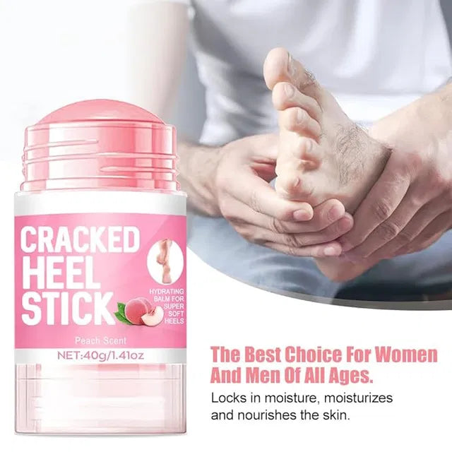 19384 Urea Cream with 2% Salicylic Acid in a 1.41 oz stick for foot and hand skin repair and restoration.