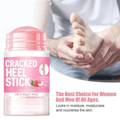 19384 Urea Cream with 2% Salicylic Acid in a 1.41 oz stick for foot and hand skin repair and restoration.