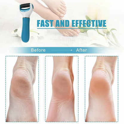 Wukusy electric dry foot file callous remover with roller for hard dead skin, battery-powered foot care device for smooth feet.