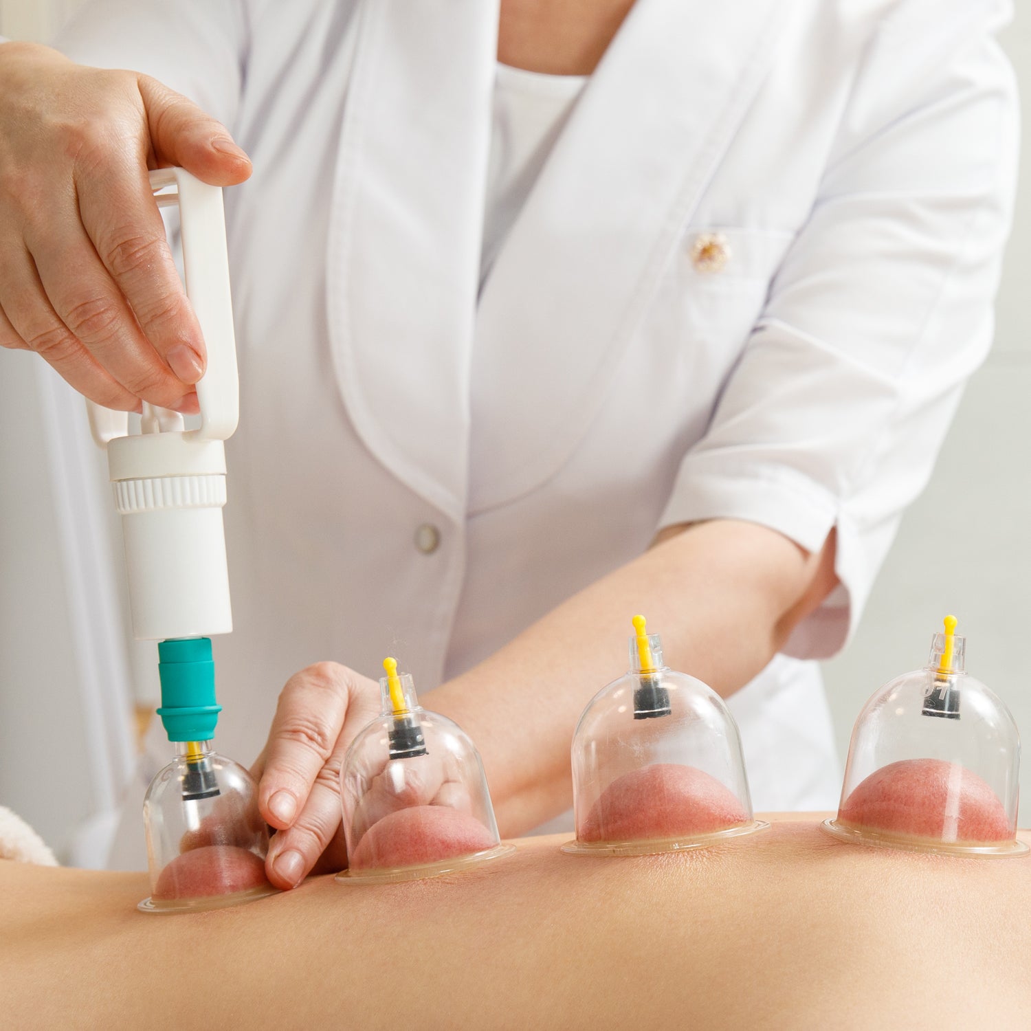 Wukusy 6-piece vacuum cupping set with curved suction pumps for therapy, relaxation, and muscle massage at home.