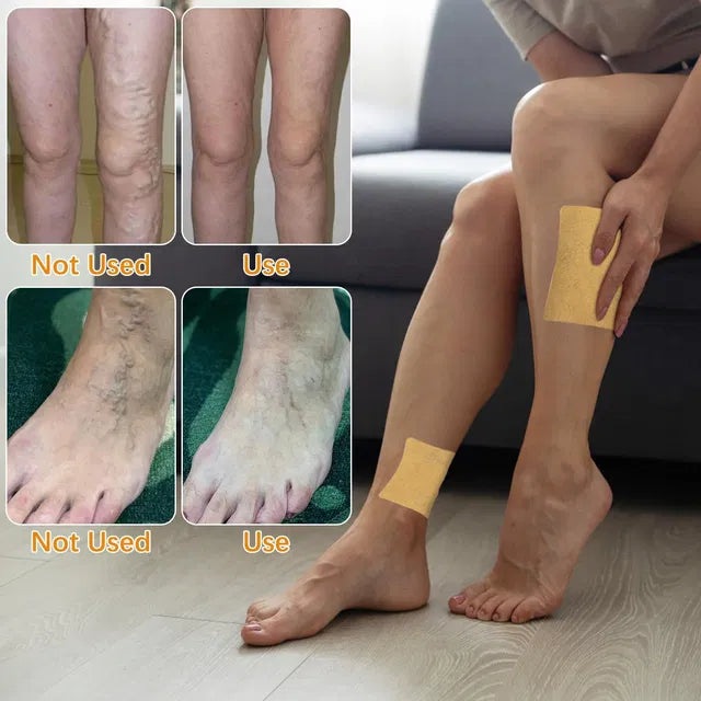 Heat patch for varicose veins and spider veins on legs, featuring turmeric for natural relief, by brand 5912.
