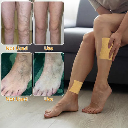Heat patch for varicose veins and spider veins on legs, featuring turmeric for natural relief, by brand 5912.