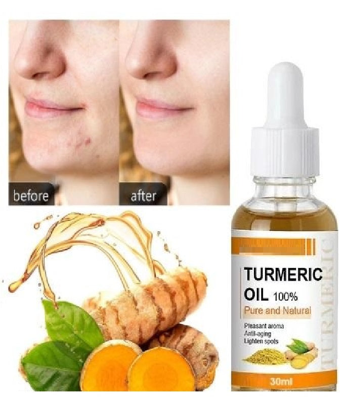 Two bottles of 30ml turmeric oil from 5912 for stretch marks and scars, with natural golden turmeric color visible in the bottles.