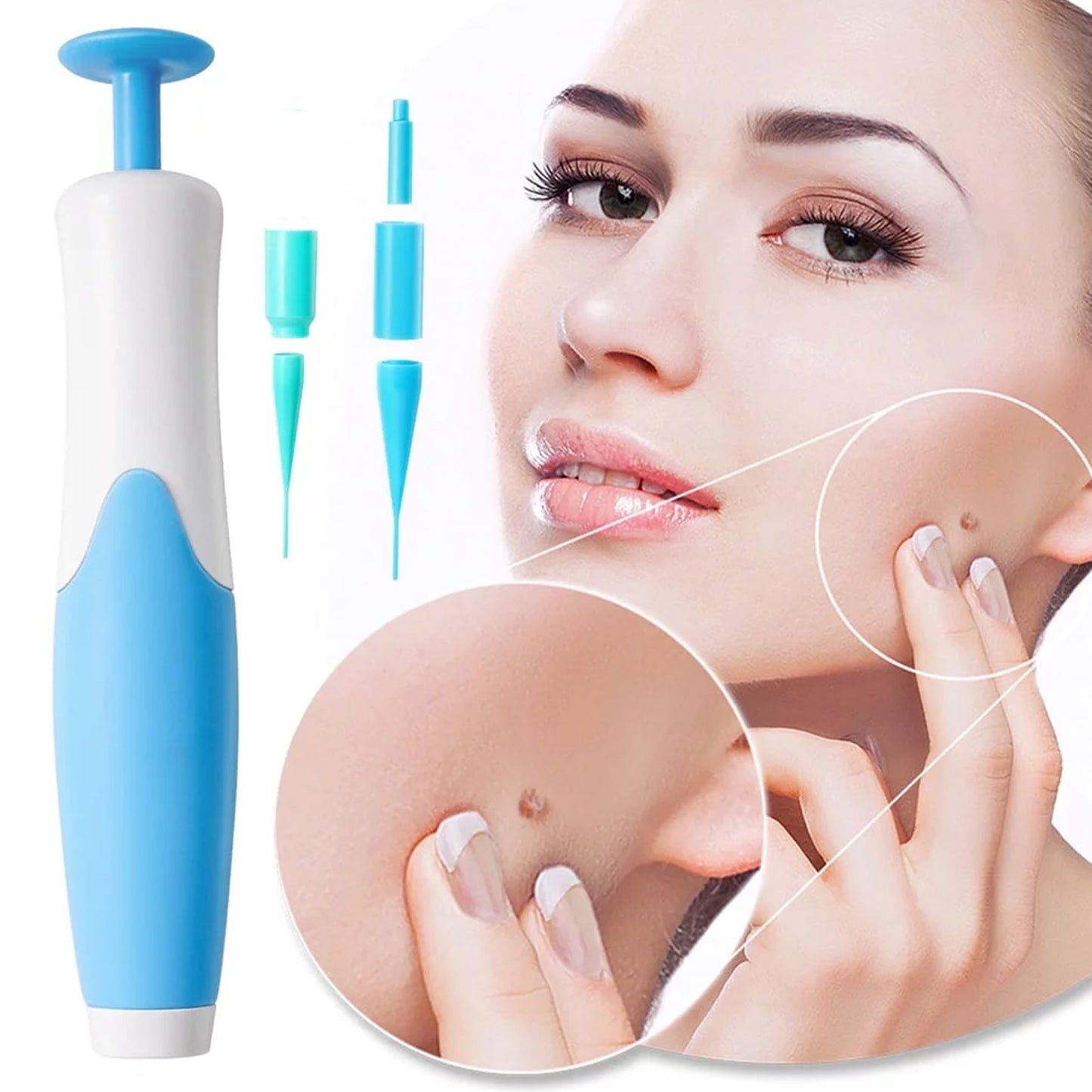 Wukusy Skin Tag Remover Kit 2-in-1 for micro to large skin tags, featuring tools for 2mm to 8mm removal in a health and beauty set.