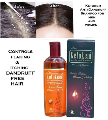 New Ketokem anti-dandruff shampoo bottle, 110ml, featuring the 6255 brand, with a sleek bottle design and label visible.