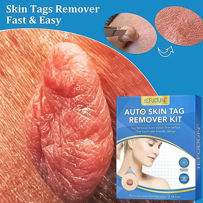 Wukusy Skin Tag Remover Kit 2-in-1 for micro to large skin tags, includes tools for safe removal of 2mm to 8mm skin tags.