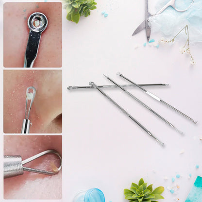 Blackhead remover 4-in-1 stainless steel pimple extractor tool by Wukusy, showing multiple tips for skincare and pore extraction.