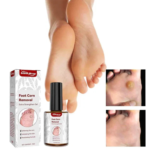 Feet Corn Removal Serum 30ml from 16182, a lightweight lip serum in a sleek bottle with a pump dispenser.
