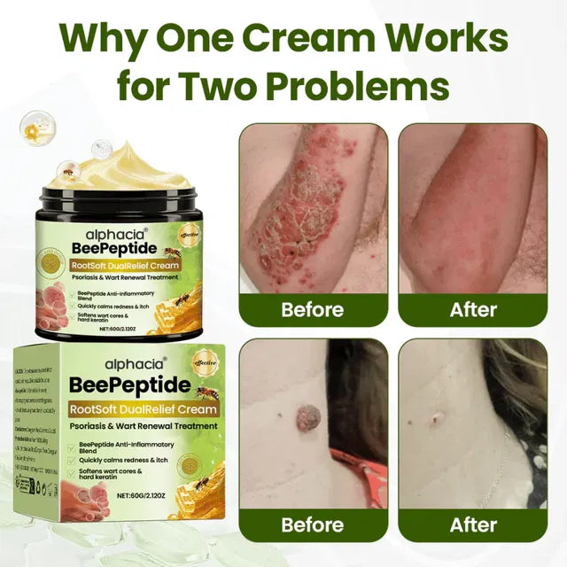 BeePeptide RootSoft DualRelief Cream pack of 2, creamy texture, labeled with brand 16182, designed for soothing skin relief.