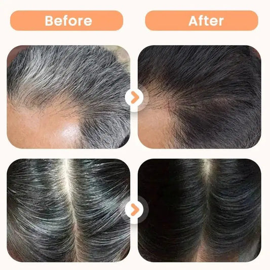 Two 200ml bottles of 1238 Plant Extract Hair Dye for Gray Hair with hair combs, showing the product bottles and combs on a white background.