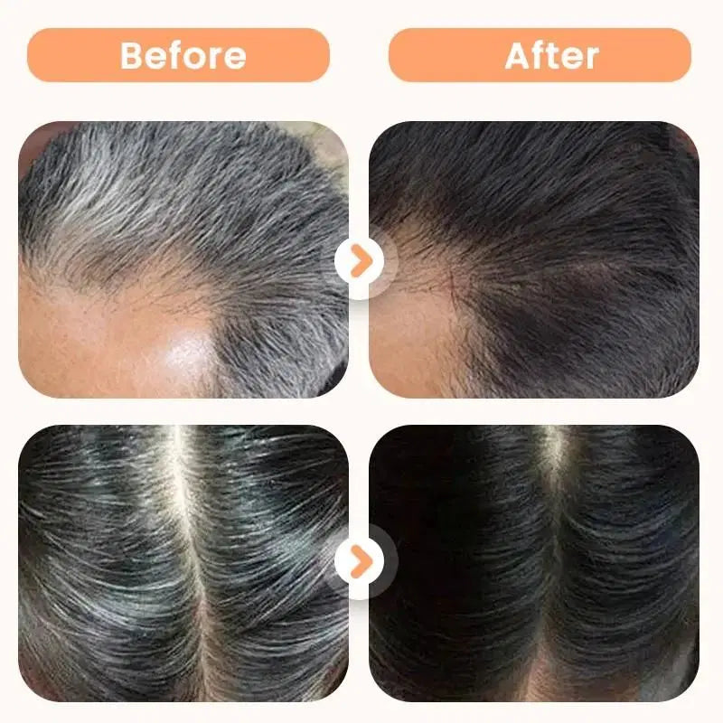 Close-up of a 1238 Plant Extract Hair Dye for Gray Hair in a 200 ml bottle, with hair combs and natural hair color in the background.