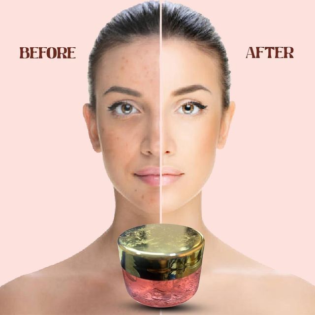 1361 Dragon Cream pack of 2, soothing creams and gels for skin relief, shown in the product image.
